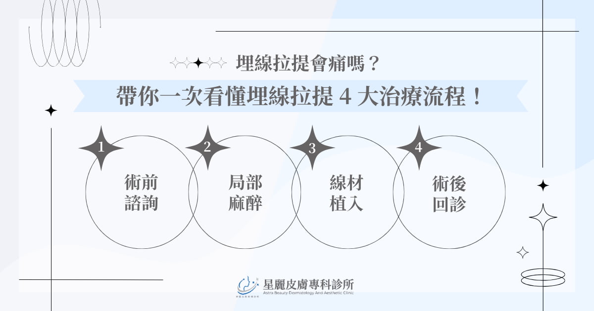 埋線拉提會痛嗎?帶你一次看懂埋線拉提 4 大治療流程!