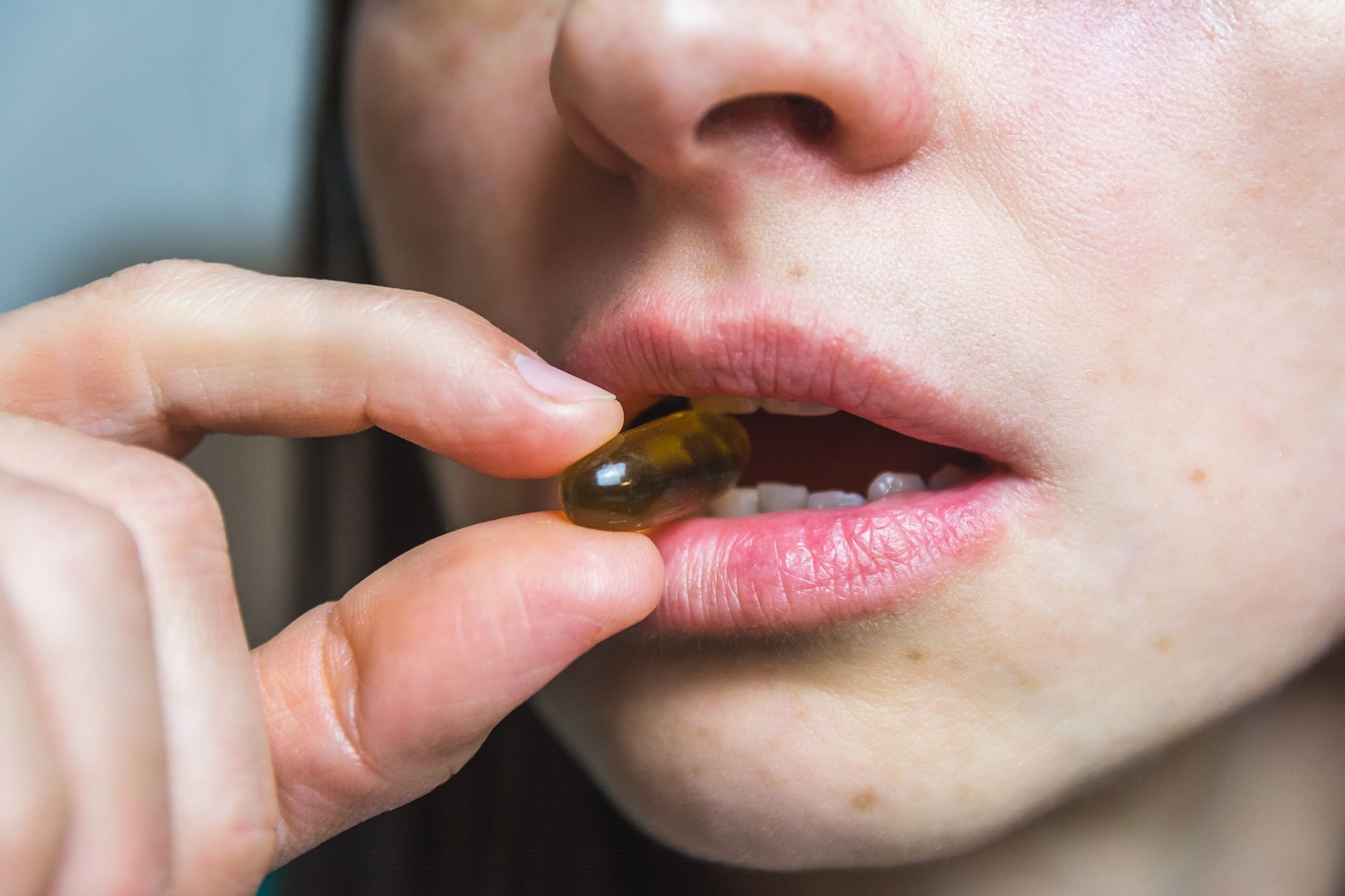 唇疱疹 herpes simplex 預防治療