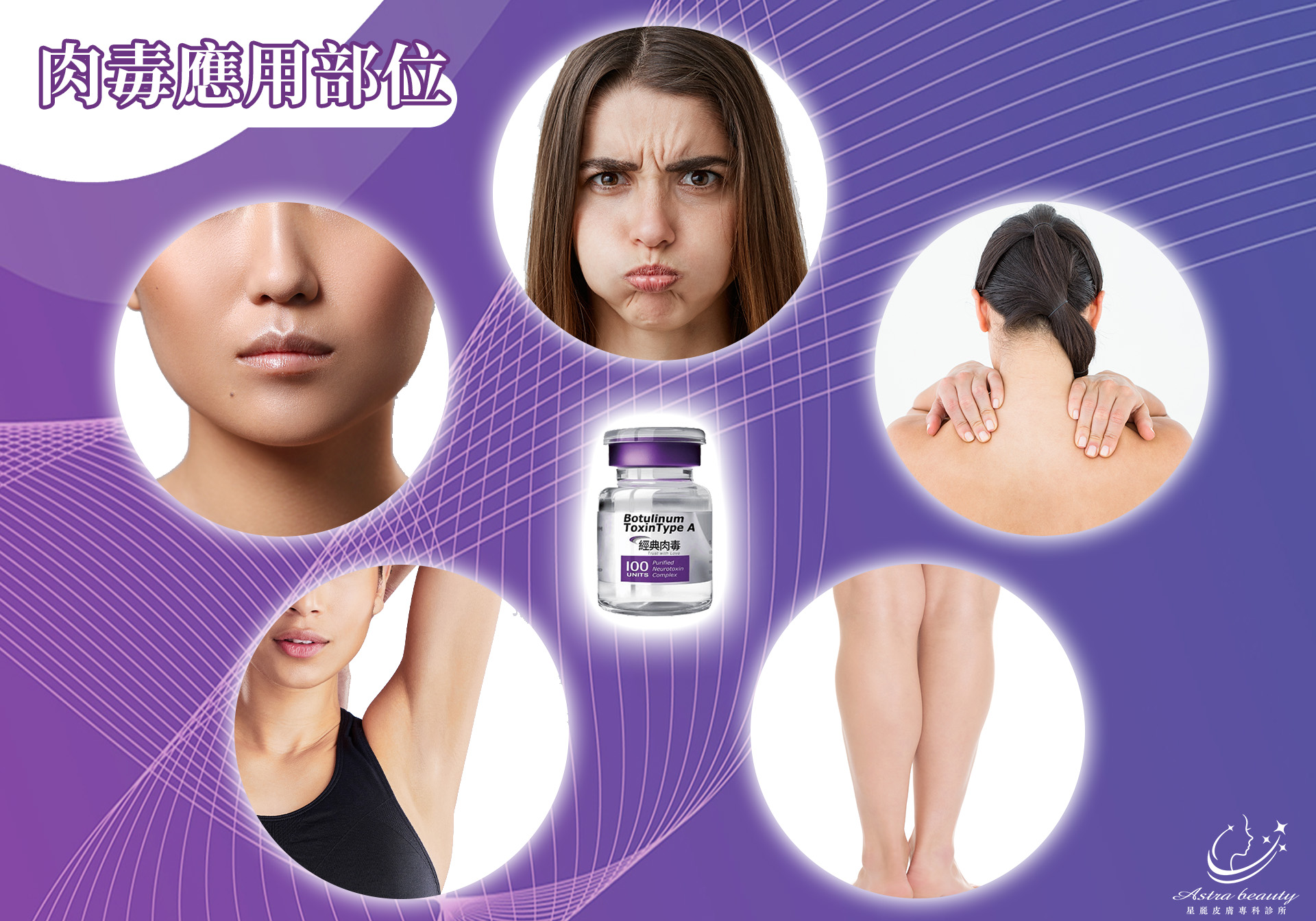 保妥適 BOTOX 經典肉毒