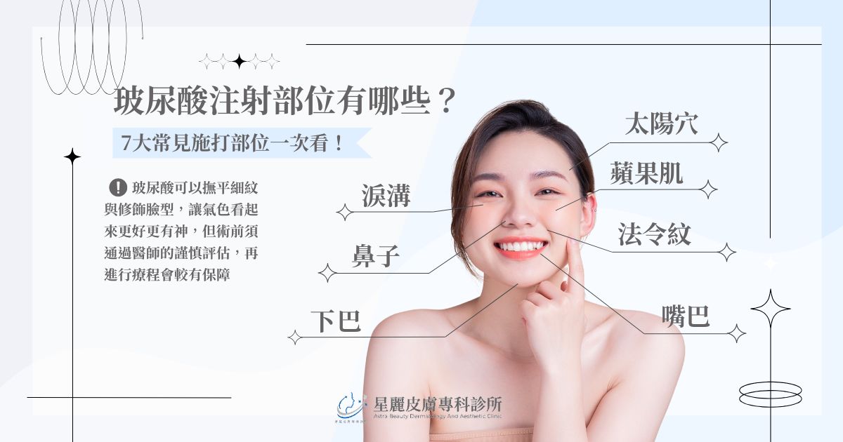 玻尿酸注射部位有哪些？ 7 大常見施打部位一次看！