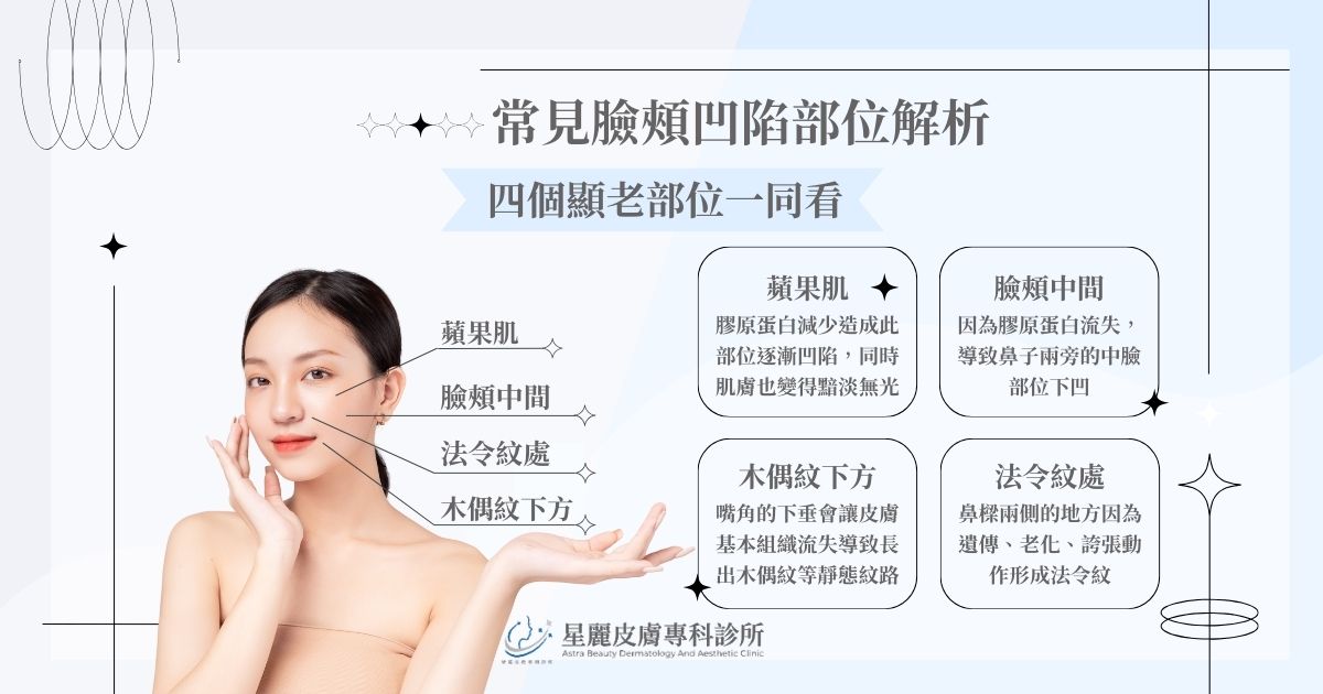 常見臉頰凹陷部位解析! 4 個顯老部位一次看!