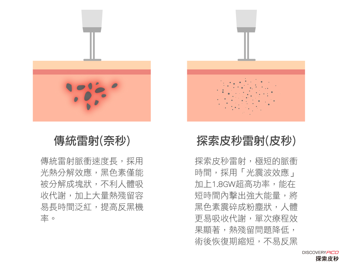 探索皮秒雷射