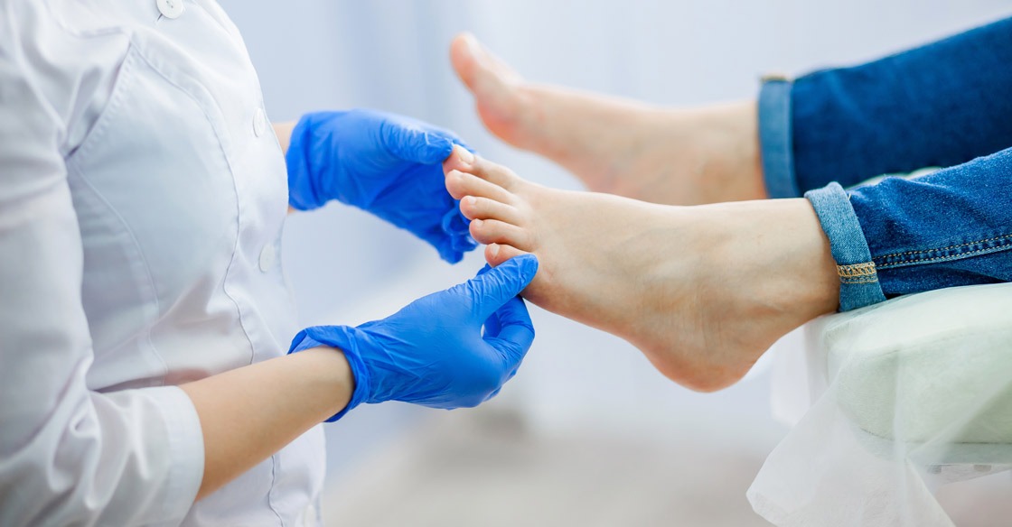 灰指甲 甲癬 (Onychomycosis )
