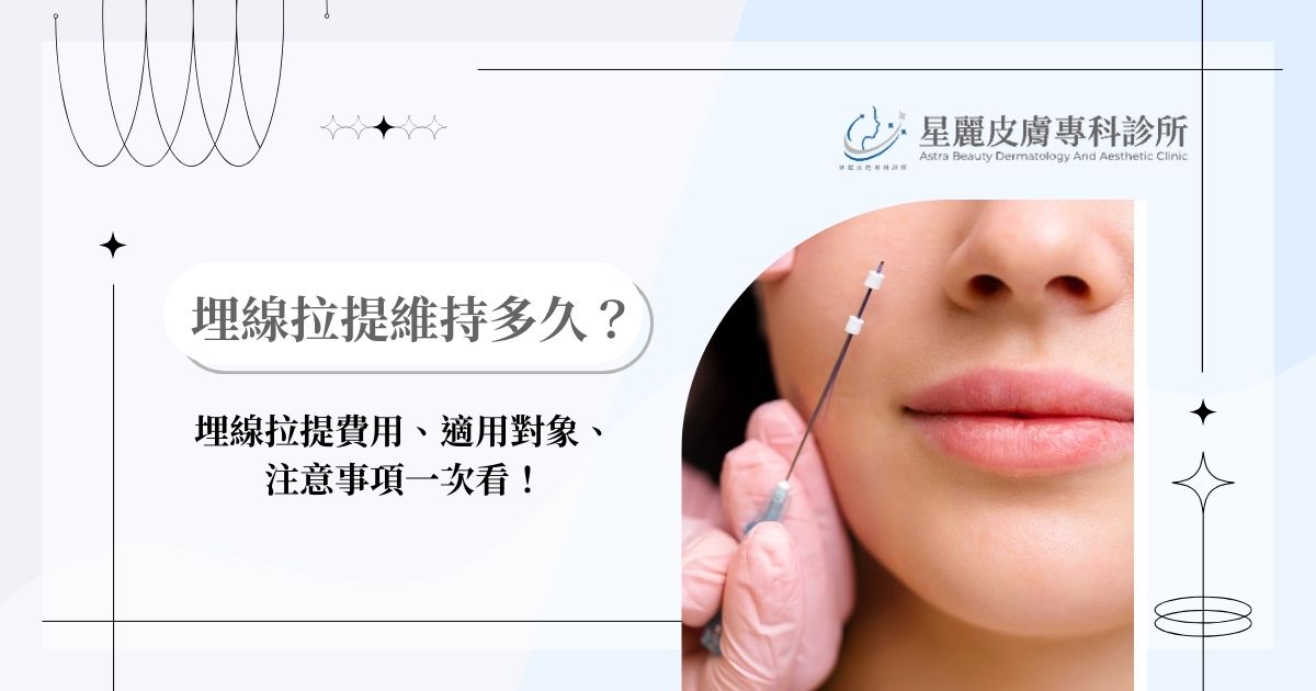 埋線拉提維持多久？埋線拉提費用、適用對象、注意事項一次看！