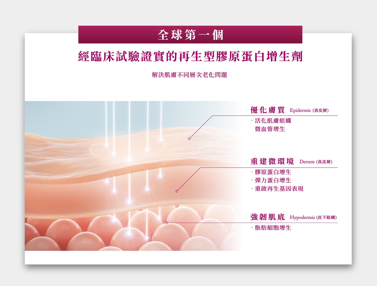 Sculptra4D舒顏萃 童顏針 童妍針 膠原蛋白增生