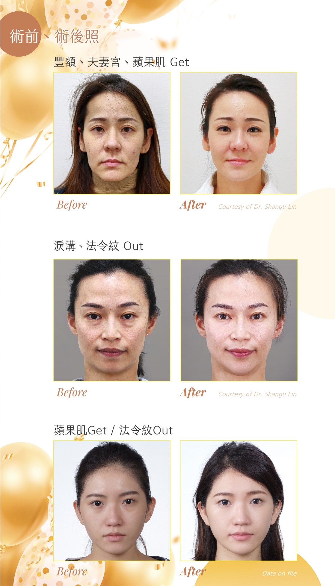 ELLANSÉ 洢蓮絲效果