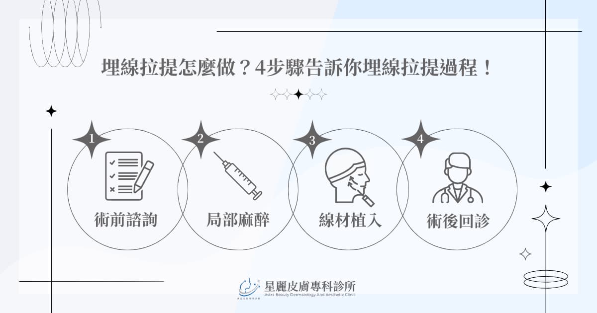 埋線拉提怎麼做? 4 步驟告訴你埋線拉提過程!