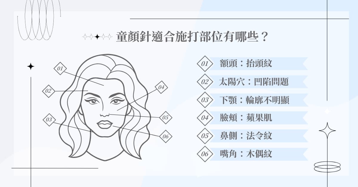 童顏針適合施打部位有哪些？