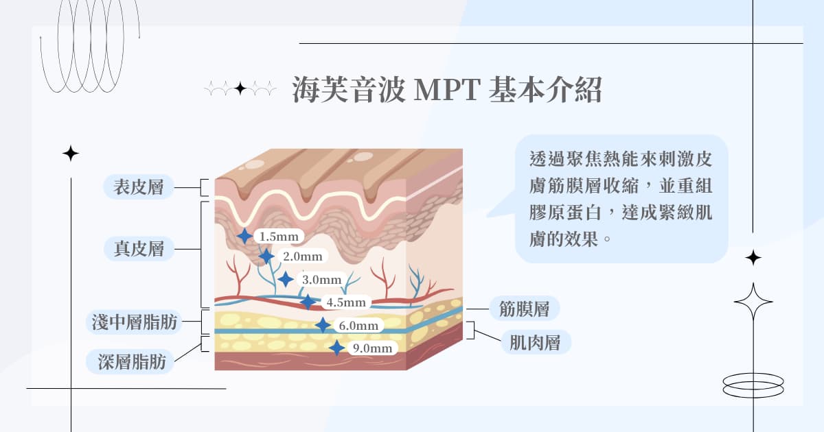 海芙音波 MPT 基本介紹
