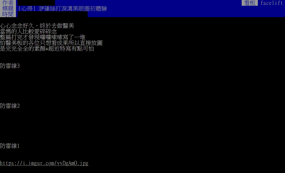 洢蓮絲失敗 ptt