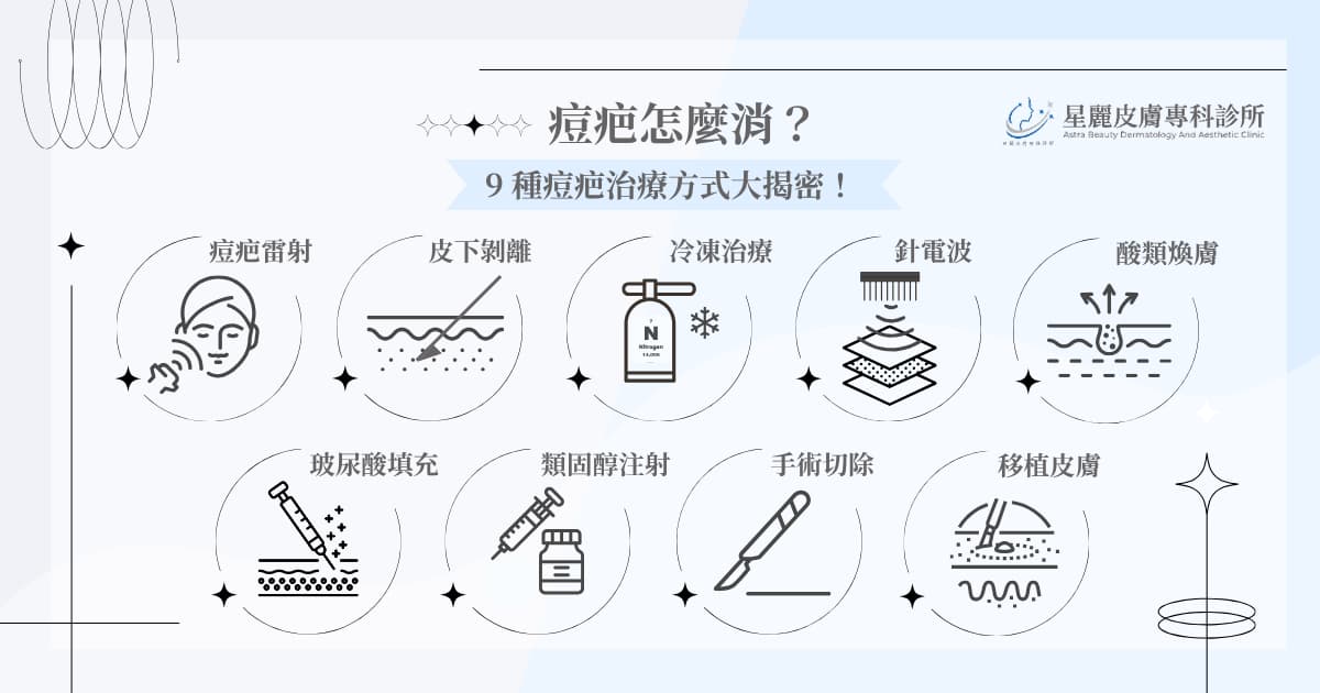 痘疤怎麼消？ 9 種痘疤治療方式大揭密！