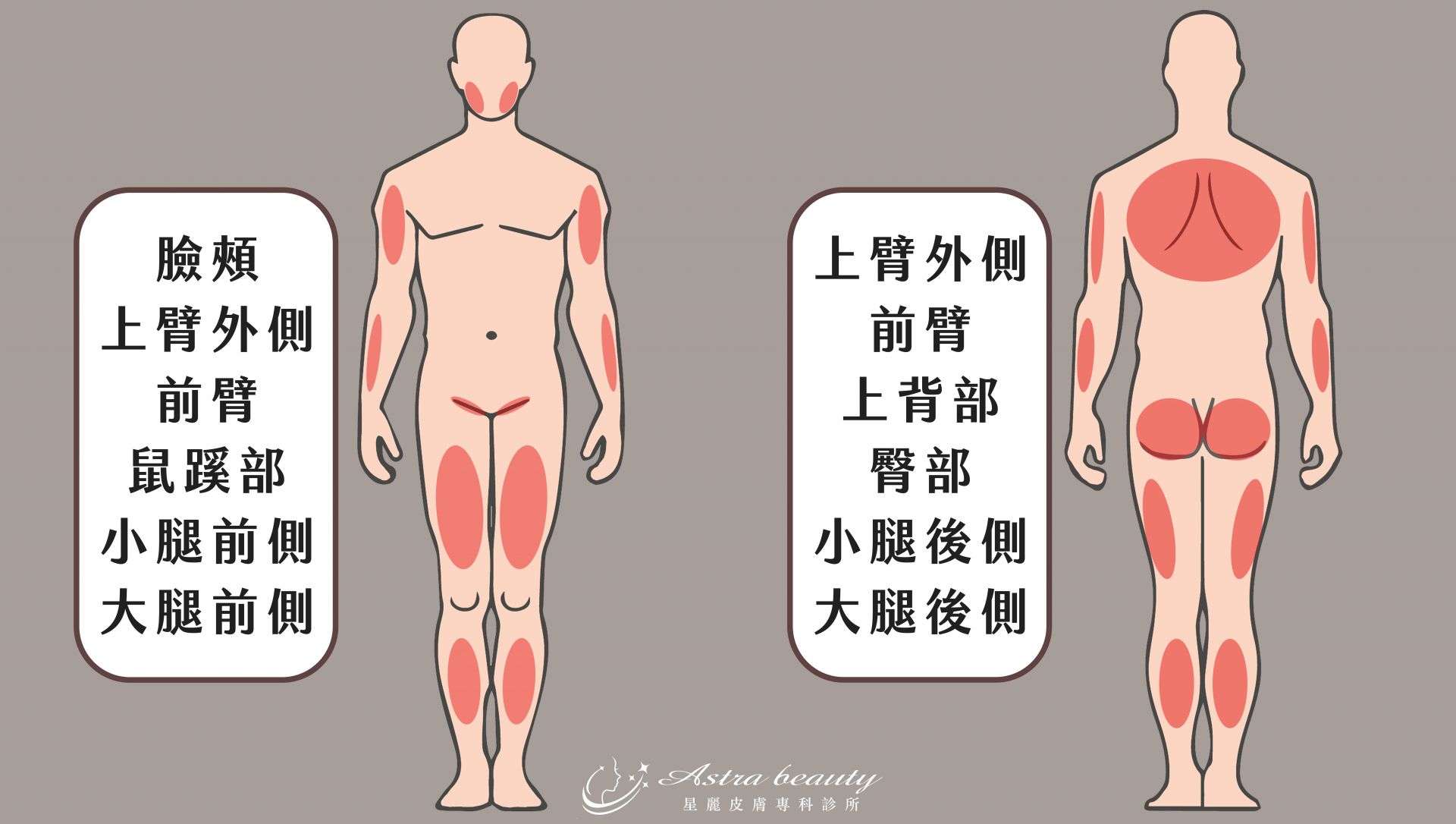 毛孔角化症常見部位