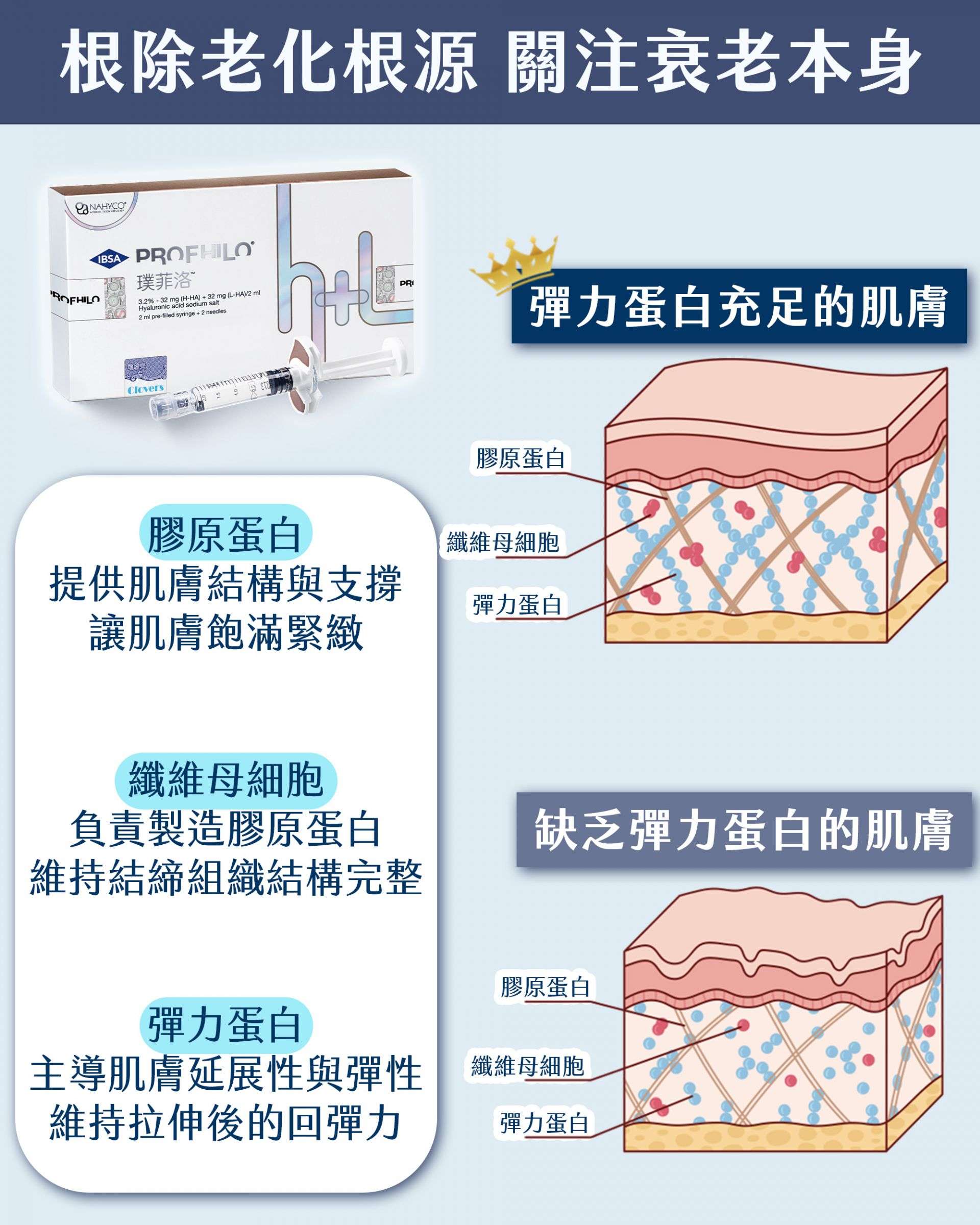 Profhilo逆時針專利技術特質