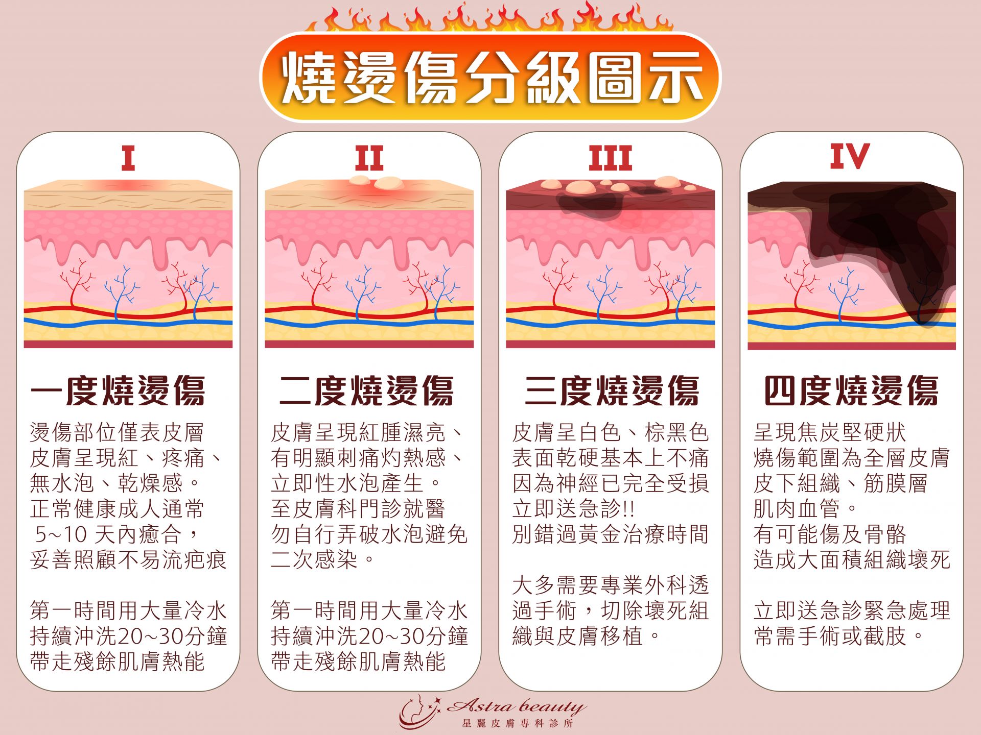 燒燙傷分級