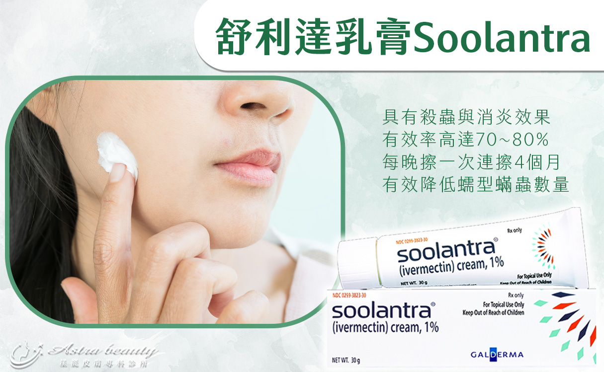 蠕型蟎蟲 舒利達Soolantra藥膏