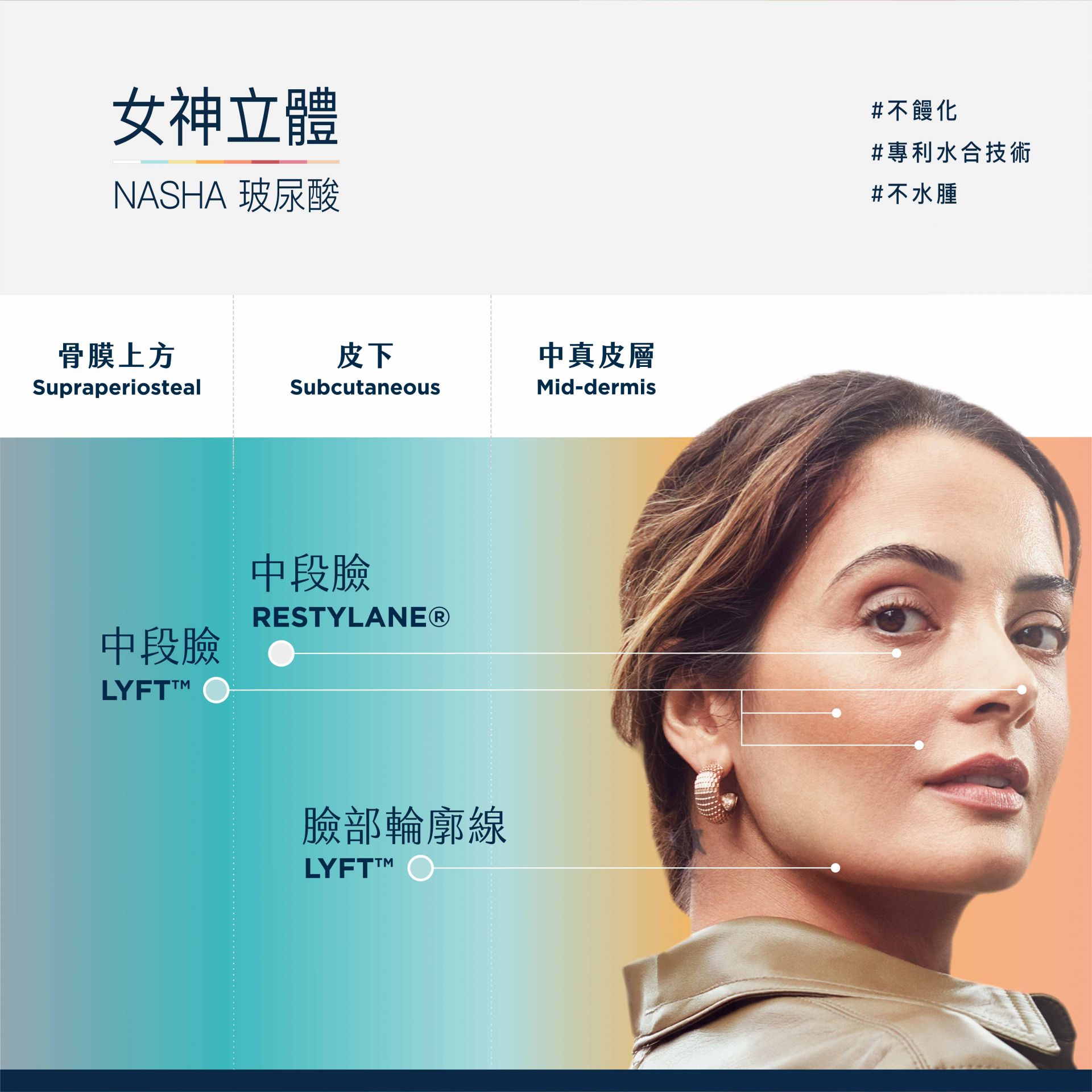 NASHA純粹玻尿酸治療部位建議