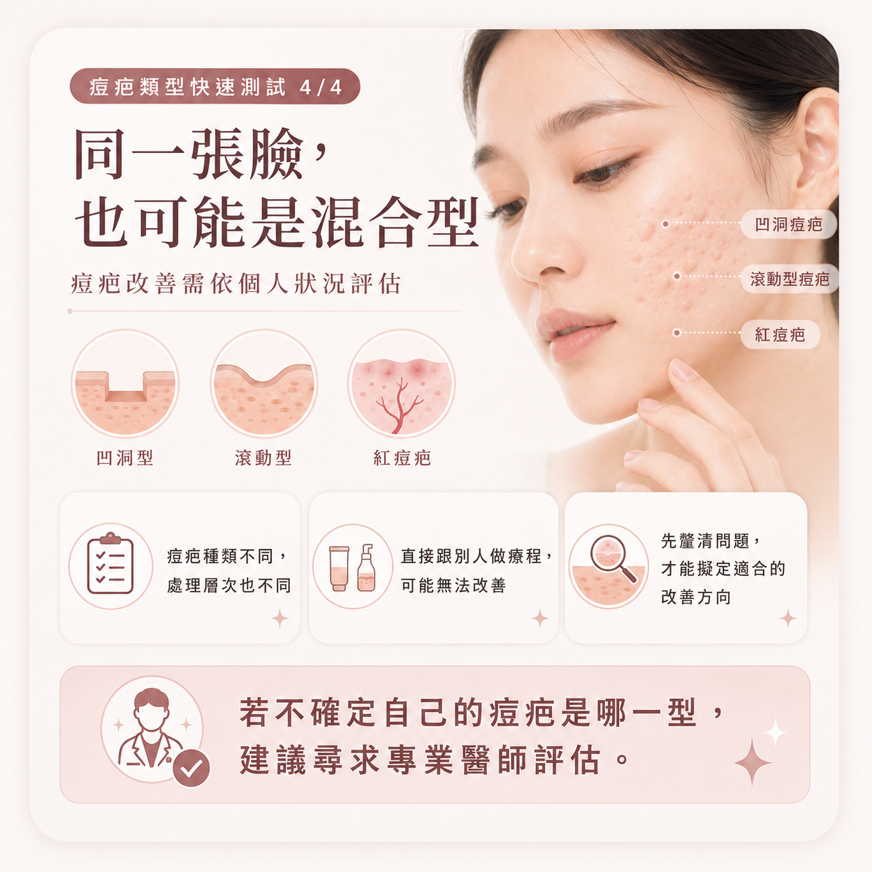 混合型痘疤與專業醫師評估