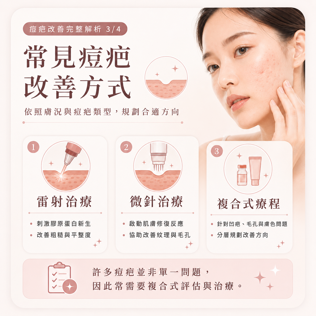 痘疤治療重點圖卡 3