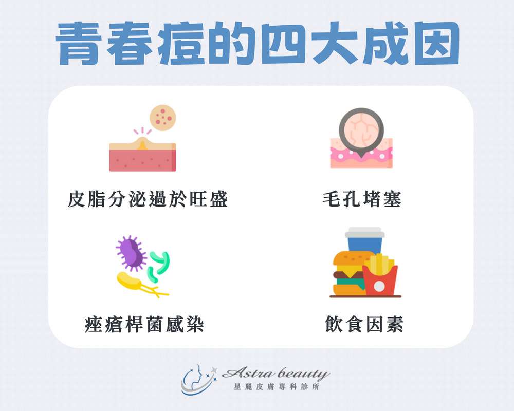台南皮膚科推薦【星麗皮膚科】消青春痘，口服A酸、痘痘針治療